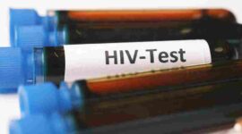 Sampel darah untuk tes HIV/AIDS (Foto: Pexels)