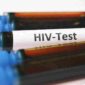 Sampel darah untuk tes HIV/AIDS (Foto: Pexels)